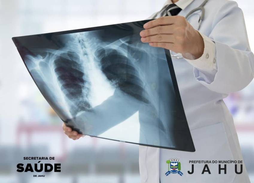REDE BÁSICA DE SAÚDE OFERECE SERVIÇO DE RAIO-X