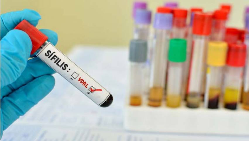 Secretaria de Saúde realiza testes rápidos para sífilis