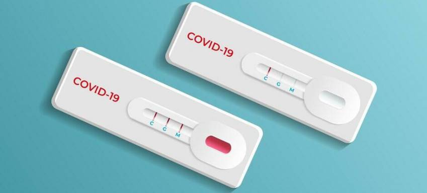 SAÚDE APLICA QUASE 11 MIL TESTES DE COVID-19